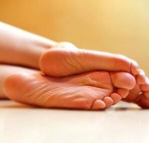 feet affected by arthrosis