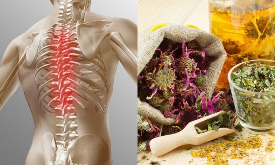 Traditional recipes - preventing the development of osteochondrosis and supporting spinal health